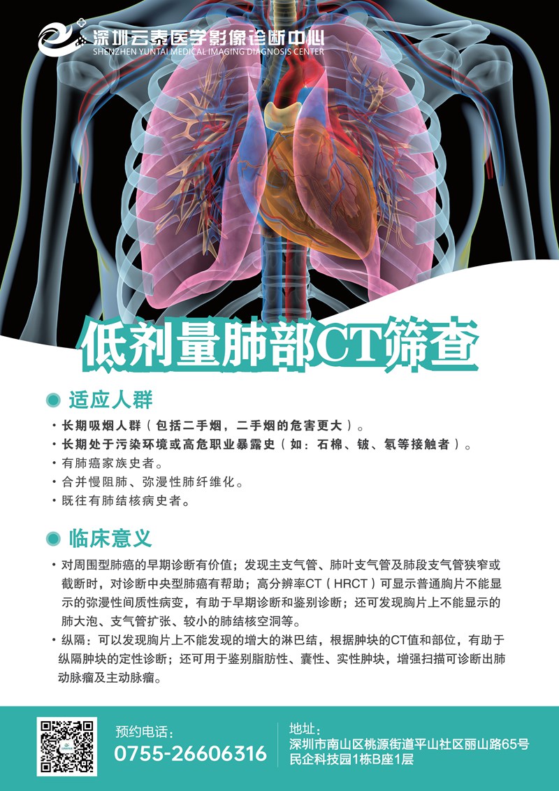 低剂量肺部CT筛查002_副本.jpg