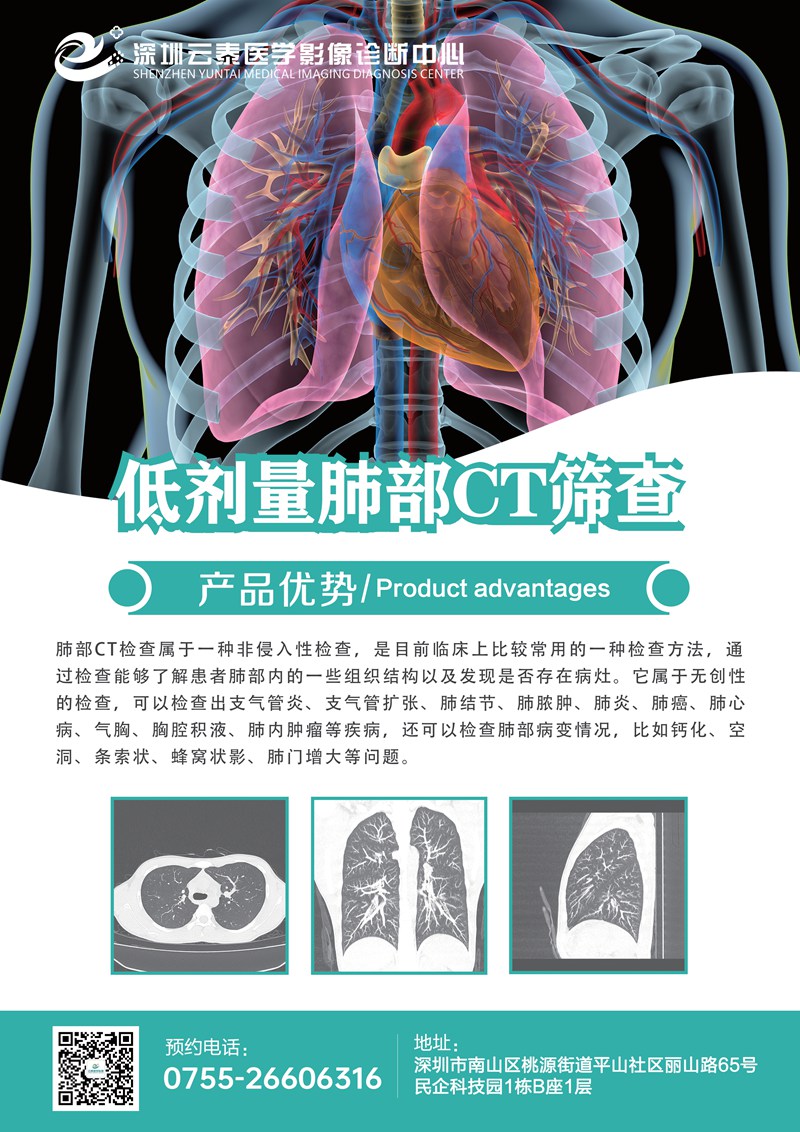 低剂量肺部CT筛001_副本.jpg